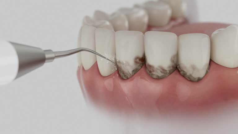 Trusted Emergency Dentist service in Aurora, MO - Dentist Open Now